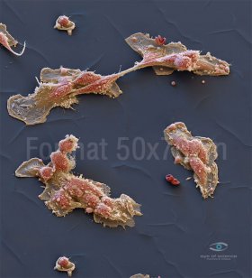 Macrophages on FirstBond
