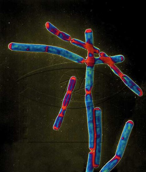 Bacterias del carbunco en FirstBond - Haga click en la imagen para cerrar