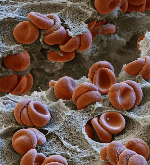 Erythrocytes on FirstBond - Click Image to Close