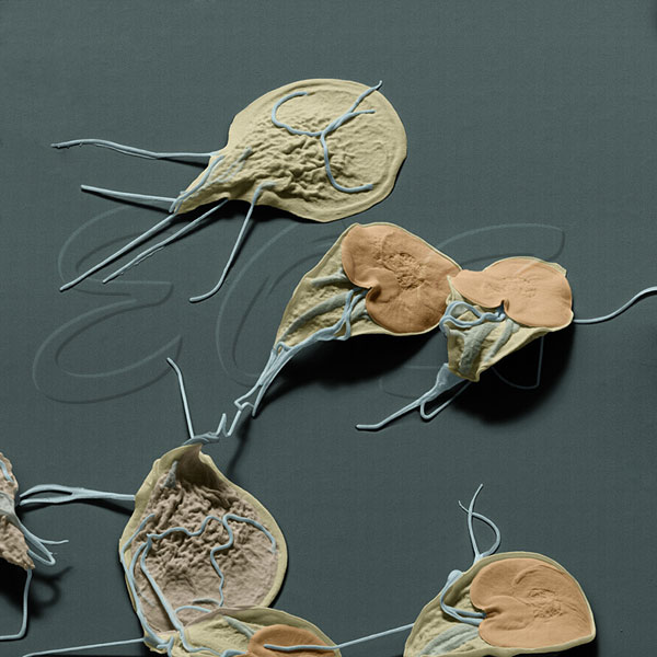 Giardiază umană - Cell papilloma face